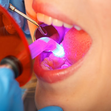 A patient getting dental bonding
