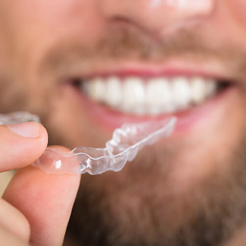 A man smiling in the background while holding a clear aligner.